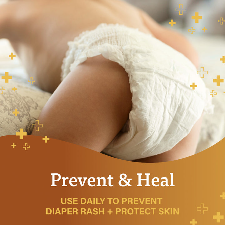 A+D Prevent + Heal Diaper Rash Ointment