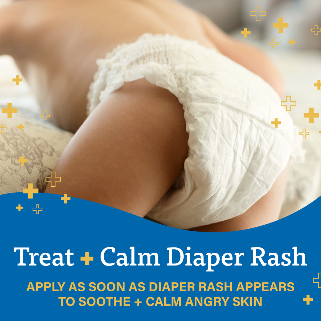 A+D Treat &amp; Heal Diaper Rash Ointment (113g)